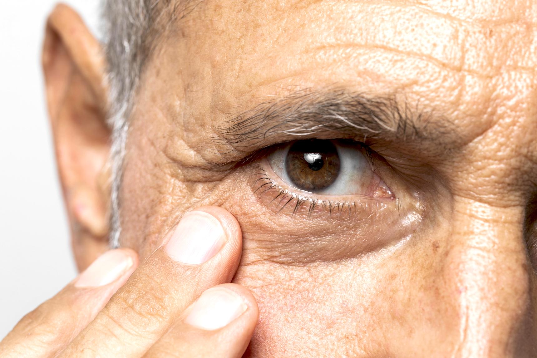 coorm salud visual retinopatia diabetica